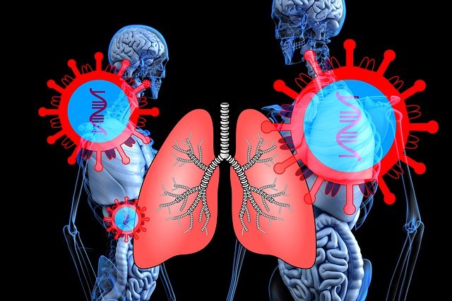 OMS: la pandemia pone en relieve la necesidad de terminar con la tuberculosis